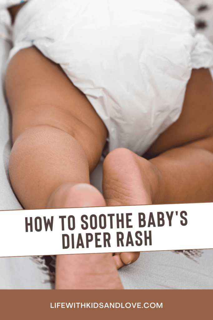 Soothing Baby's Diaper Rash